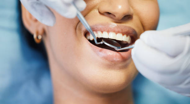 Best Emergency Treatment for Dental Infections or Abscesses in Odenton, MD